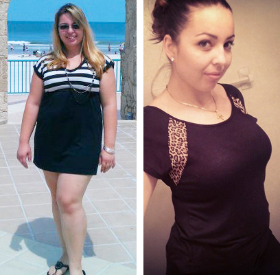 Alexandra before and after