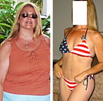 Barbara before and after