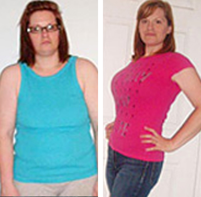 Linda before and after